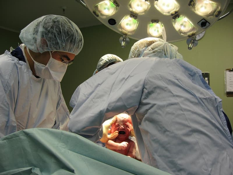 ‘Crazy’: How society views mothers planning vaginal breech birth