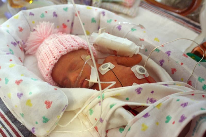 Life and death decisions for micro prems