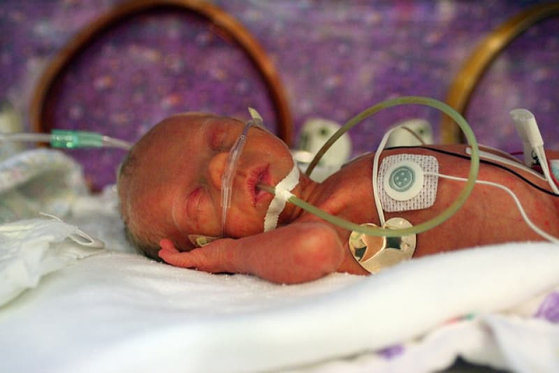 Are we prioritising “precious” babies?