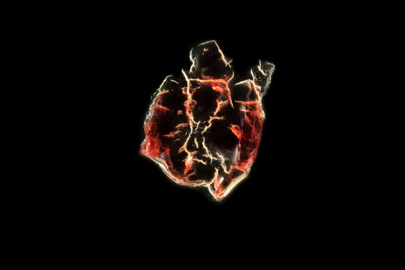 How African Caribbean Women cope with stroke