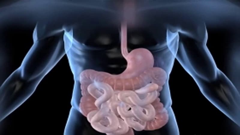 How to reduce your risk of bowel cancer