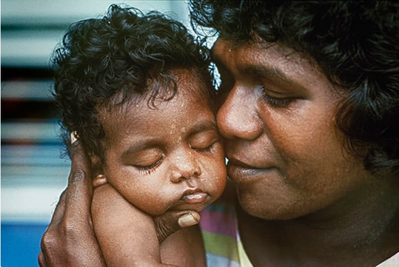 Outcomes for NT mums & bubs improve with MGP