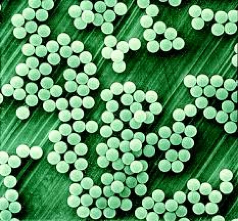 The tiny beads that have become an environmental menace