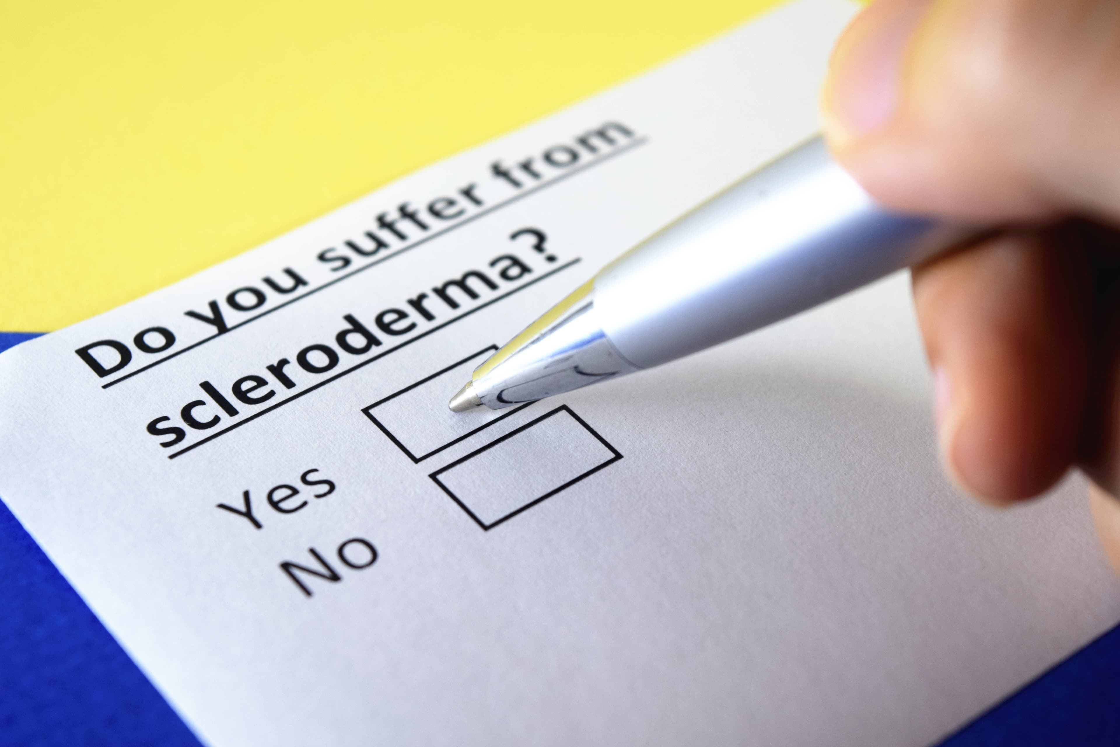 A Closer Look at Scleroderma Disease