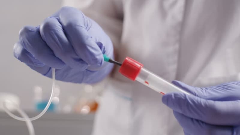 Opioid Addiction on the Rise?