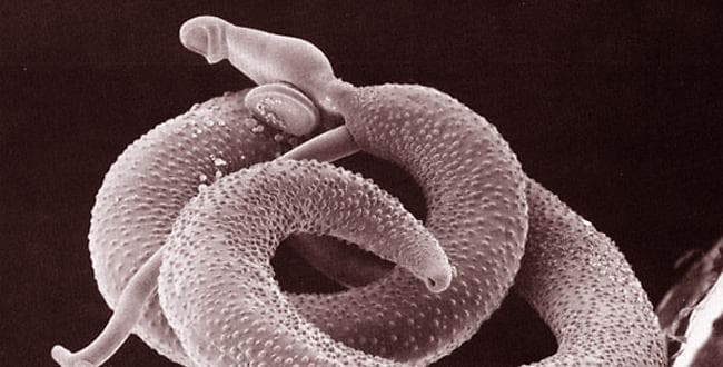 Would you infect yourself with a parasitic worm?
