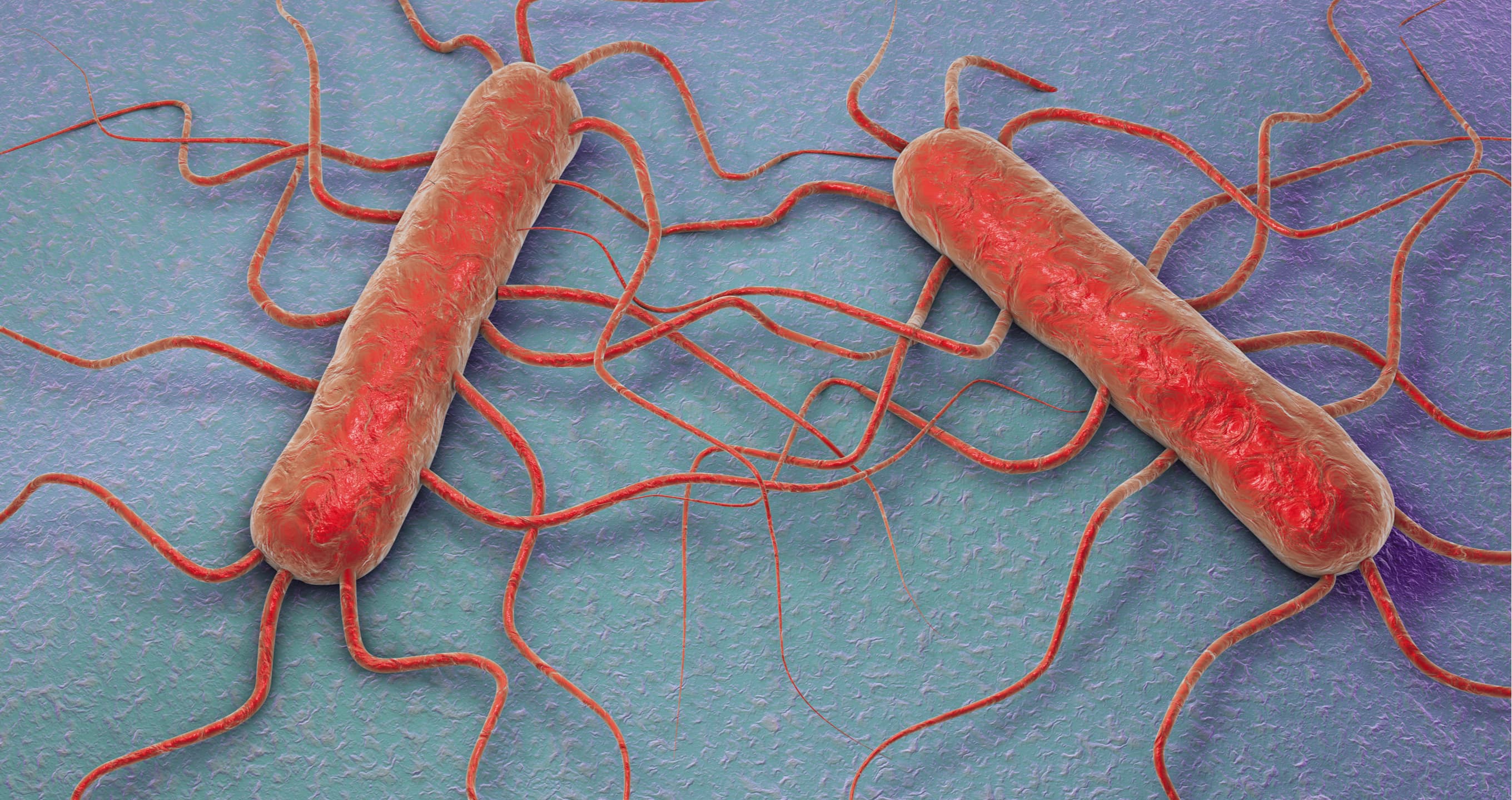 NSW Experiencing Spike In Listeria Infections