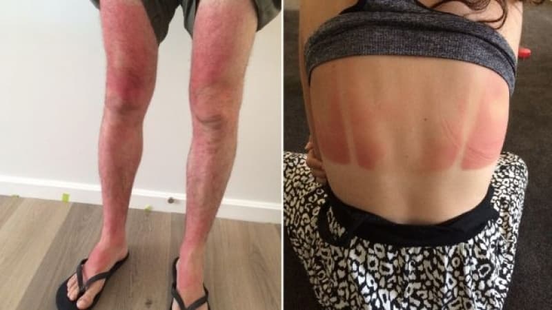 A Guide to Sunscreen