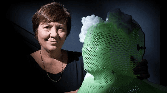 Julie McCrossin: head and neck cancer survivor