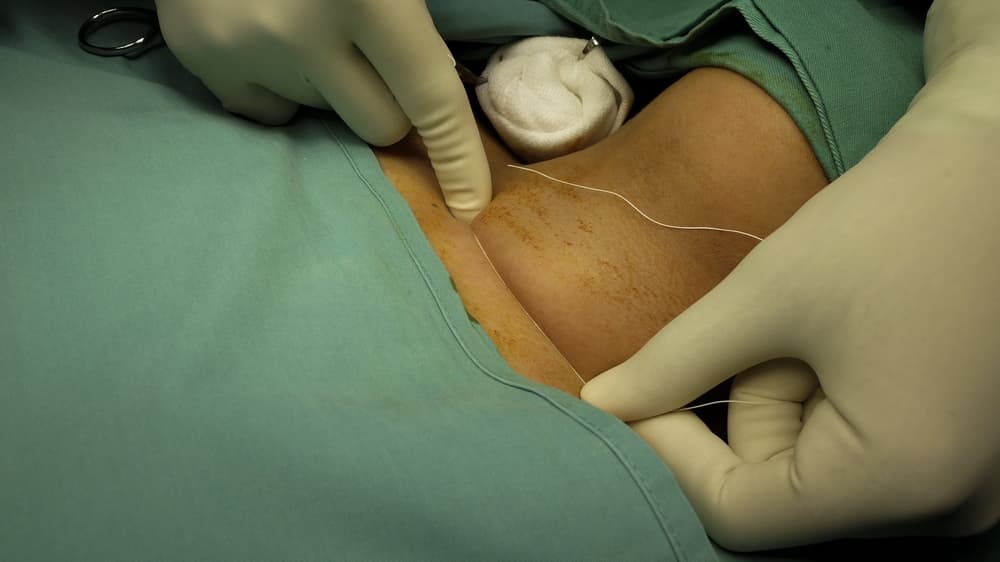 Advice and support for head and neck cancer patients