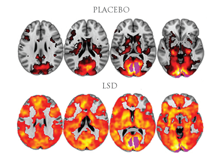 The Positive Effects Of Microdosing LSD: All In The Mind?