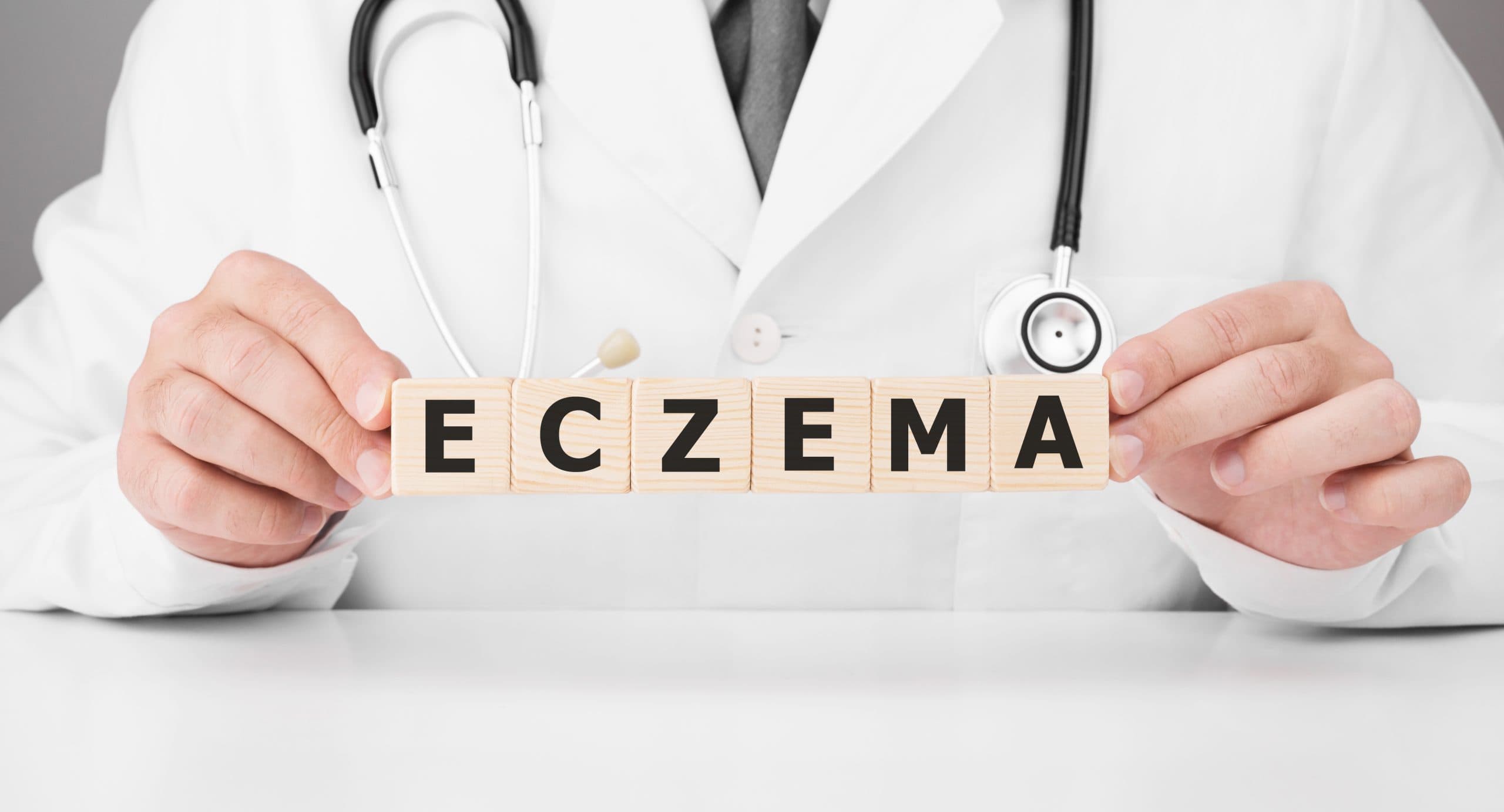 The Rise of Eczema: Causes, Symptoms and Treatments