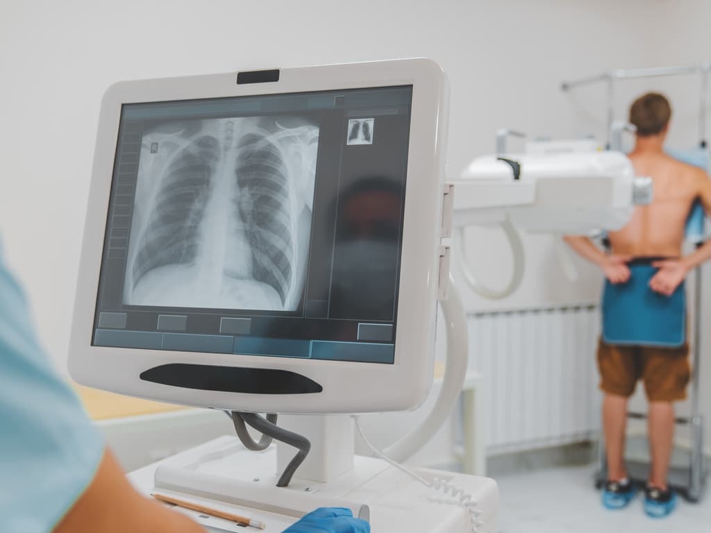 To screen or not to screen?