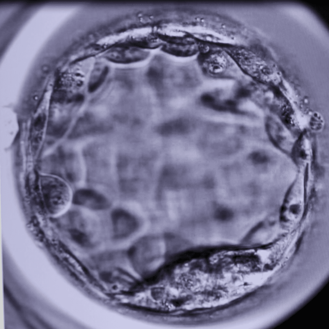 Groundbreaking research on IVF gives hopes to couples