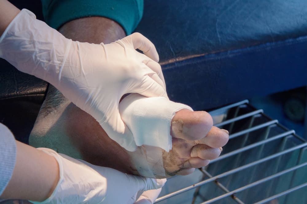 Super Bugs about to be squashed