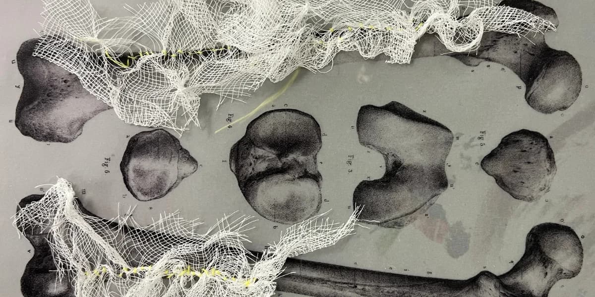 Your non-normative bones and you – Bone drift: Chimeric conversations