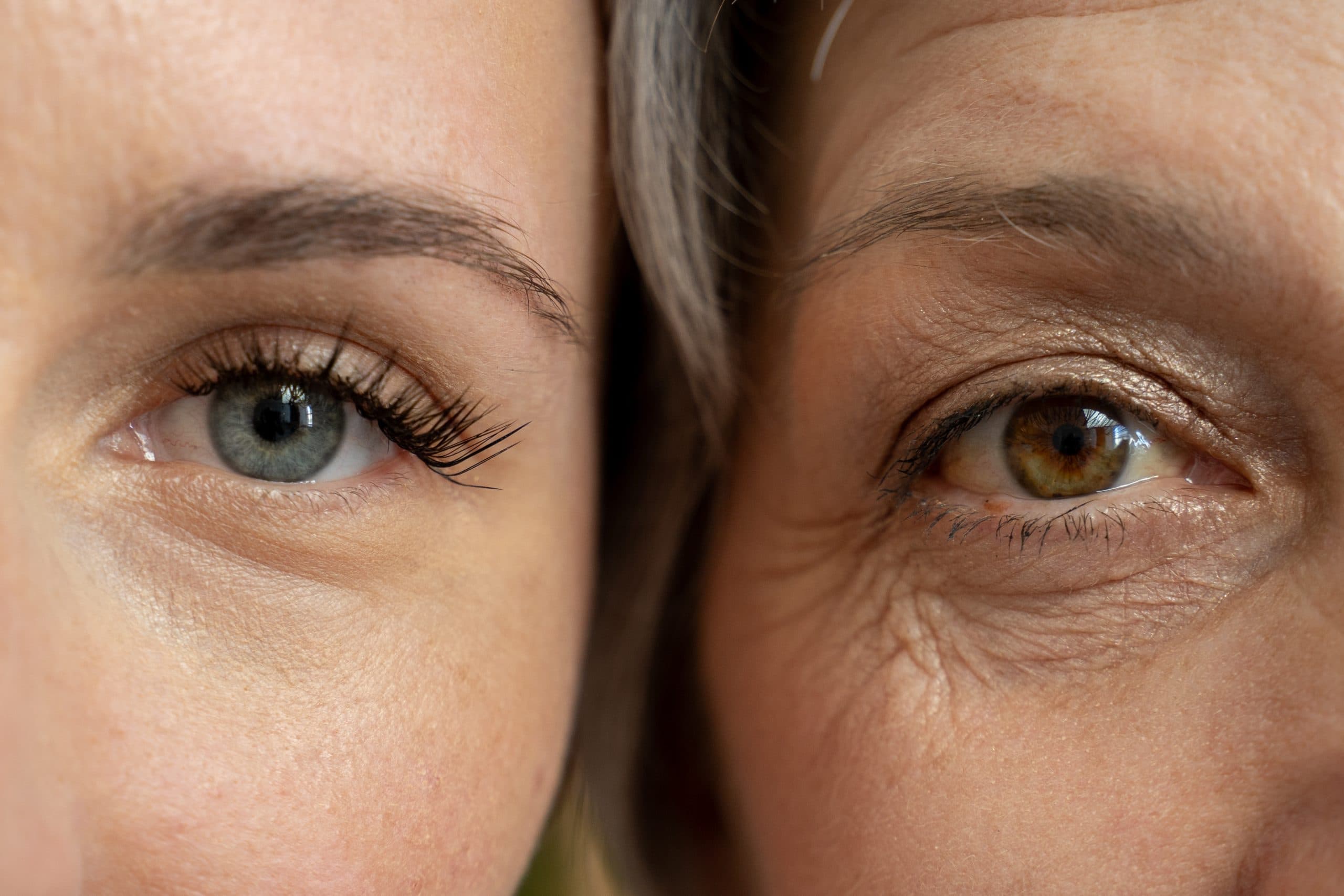 A close-up side-by-side view of one eye and cheek of a young woman and of an older woman, highlighting the visible differences in skin texture and wrinkles.